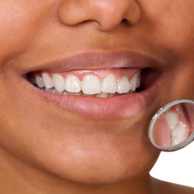 Non-Surgical Gum Care