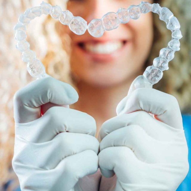 Clear Aligners